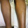 Cavitation and Body Wrap