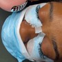 Eyelash Extension Removal