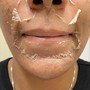 Lip & Chin Wax