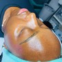 Oxygen Rx Facial