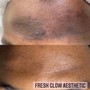 Face Reality Clarifying Acne Facial