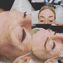 Dermaplaning facial treatment