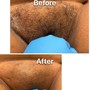 Brazilian Wax