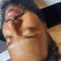 Oxygen Facial