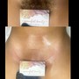 6-8 week Brazilian Wax