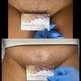 Brazilian Wax w/ butt strip