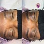 Eyebrow: Microblading