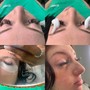 Eyelash Extension Removal