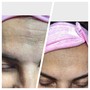 Glycolic Peel