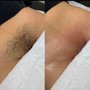 Brazilian Wax