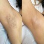 Underarm Wax