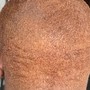 Scalp Treatment/scalp exfoliation