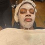 Acne Facial