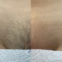 Brazilian Wax