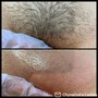 Underarm Wax