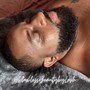 Microdermabrasion