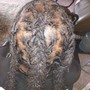 Scalp Treatment Herbal