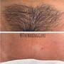 Brazilian Wax