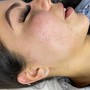 Eyelash Extension Removal