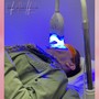 MicroNeedling