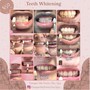 30 Minute Teeth Whitening