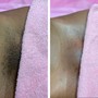 Brazilian Wax