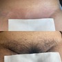 Men's Back Wax