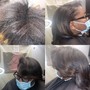 Scalp Treatment