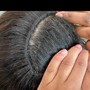 Scalp Treatment