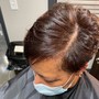 Scalp Treatment