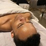 Microdermabrasion