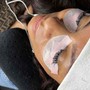 Microdermabrasion Facial