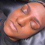 Microdermabrasion Facial