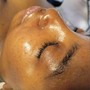 Microdermabrasion