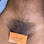 Stomach strip