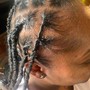 Scalp Treatment