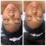 Dermaplane facial