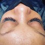 Eyelash Extension Removal