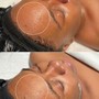 Dermaplane + Custom Facial