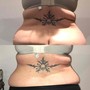 Cryo fat freezing and reduction