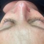 Eyelash Extension Removal