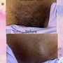 Brazilian Wax