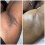 Brazilian Wax