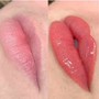 Baby Doll Technique Lip Filler (1.5 ml)