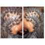 Scalp Treatment