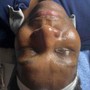 REJUVENATE FACIAL