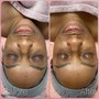 Microdermabrasion (Service add on)