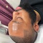 Back Facial “ Treatment”