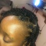 Scalp Treatment