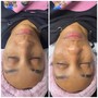 Dermaplane facial